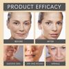 2Pcs Furzero Bee Venom Wrinkle Removal Cream, for All Skin Types