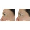 DNA Code®-No Needle Alternative-Argireline Copper Peptide Wrinkle Reduce Serum Booster w/Snap-8, Matrixyl 3000