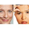 ANTI-WRINKLE COMPLEX - 1B - Youthful Radiance Caps - 60 Count