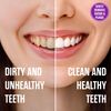 Sprinjene Fluoride Free Toothpaste for Sensitive Teeth & Gum - All Natural Toothpaste Fluoride Free Toothpaste Adult, SLS Free, Non Fluoride Toothpaste Adult - 2 Pack Toothpaste Floride-Free