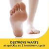 Dr Scholl's Dual Action Freeze Away Wart Remover, 8 ct – Twice as Effective as Freezing Alone on Larger Warts, Fast-Acting Treatment for Common and Plantar Wart Removal, Safe to Use on Kids Ages 4+