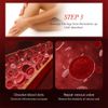 Varicose Veins Relief