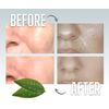 EcoFeminii Green Tea Oil Control Blotting Sheets-100 pcs Natural Papers for Clear, Clean & Matte Skin-Removal of Facial Oil & Sebum (Medium (6cm x 9cm))