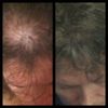ProGrowth Shampoo
