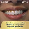 Waterpik Aquarius Water Flosser - White (WP-660)