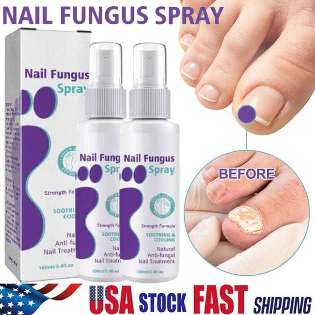 2Pack 100ML Medinail Fungus Spray,Toenail Fungus Treatment,Nail Fungus Treatment