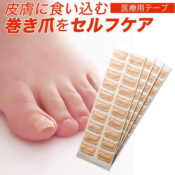 Ingrown Nail Correction Tape Ingrown Nail Care PRO Support Seal Medical Use 1.8 x 1cm 80 Stickers (20 x 4 Sheets) Nail Polishing Sheet 1 Skin Color Resin Plate Self Care Support Seal Made in Japan Beauty Cogit [Mail Delivery]