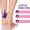 Glamza Foot Pumice Sponge Callus Exfoliate Stone Hard Skin Remove Pedicure Scrubber Pack of 4