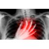 Boost Heart Function Caps - Blood Pressure Complex - Blood Pressure Support 3B