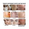 CEAVO DARK SPOT REMOVER FOR FACE 1.06 FL OZ