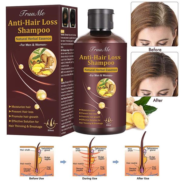 Hair Growth Shampoo, Hair Loss Shampoo, Hair Thickening Shampoo, Helps Stop Hair Loss, Grow Hair Fast, Hair Loss Treatment for Men & Women (220mL)