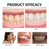 Aligner & Retainer Cleaner - Clear Solution for Mouth Guards, Whitening & Cleaning, Includes 60ml Cleaning Foam. Ideal for Teeth Alignment