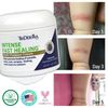 TriDerma Intense Fast Healing Cream, Decreases Healing Time for Minor Irritations, Rashes, Scrapes, Cuts 4 Ounces
