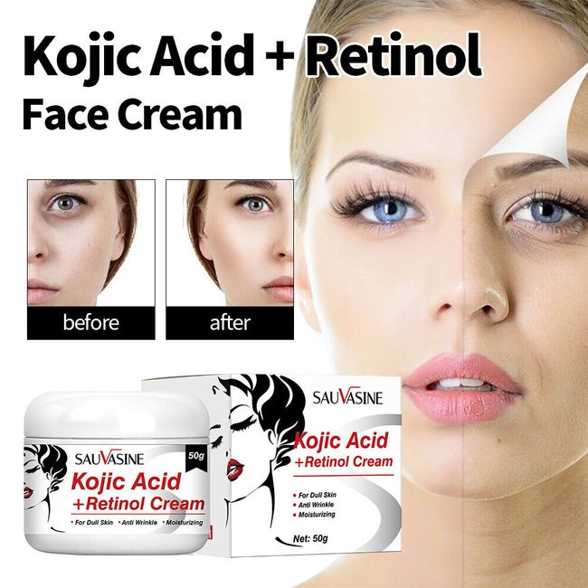 2pcs Kojic Acid Retinol Cream Skin Whitening Cream Remove Dark Spots Anti Aging
