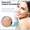 Dark Spot Remover For Face, Hyperpigmentation Treatment, Dark Spot Serum, Melasma treatment for face, Blemish spot treatment, Freckle Remover for Sun Spots, Acne Scars, Melasma for Men & Women, 30g