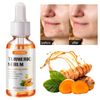2 Pack Turmeric Serum for Dark Spots, Turmeric Dark Spot Corrector Serum for Acne, Hyperpigmentation and Smooth Skin, Formulated with Hyaluronic Acid, Vitamin C & E - 1.01 FL.OZ