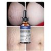 stretch marks Moisturize, Smooth, Firm, Repair
