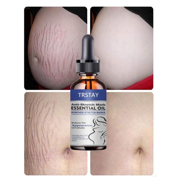 stretch marks Moisturize, Smooth, Firm, Repair