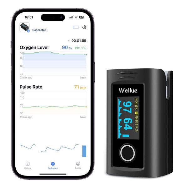 ViATOM Bluetooth Pulse Oximeter Approved UK Built-in Offline Storage, Oxygen Monitor finger Adults for Heart Rate Blood Oxygen Saturation Includes Carrycase and Lanyard, Free APP