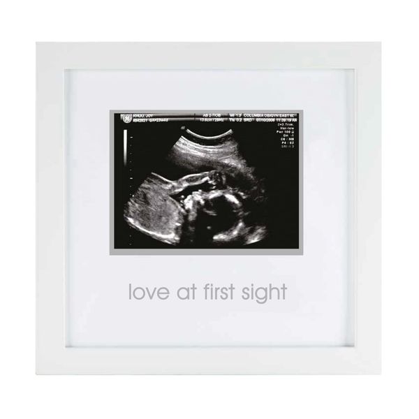 Pearhead Love at First Sight Sonogram Picture Frame, Pregnancy Ultrasound Keepsake Photo Frame, Gender-Neutral Baby Nursery Décor, 4x3 Photo, White