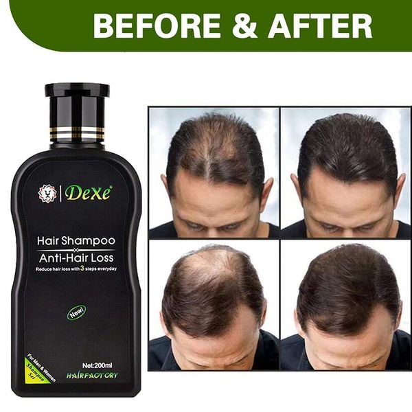 DEXE Hair Growth Shampoo, Anti-Hair Loss Shampoo, Hair Regrowth For Men & Women