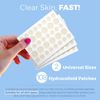 Miracle Hydrocolloid Pimple Patches, Acne Patch Invisible Spot Cover (108 Count)