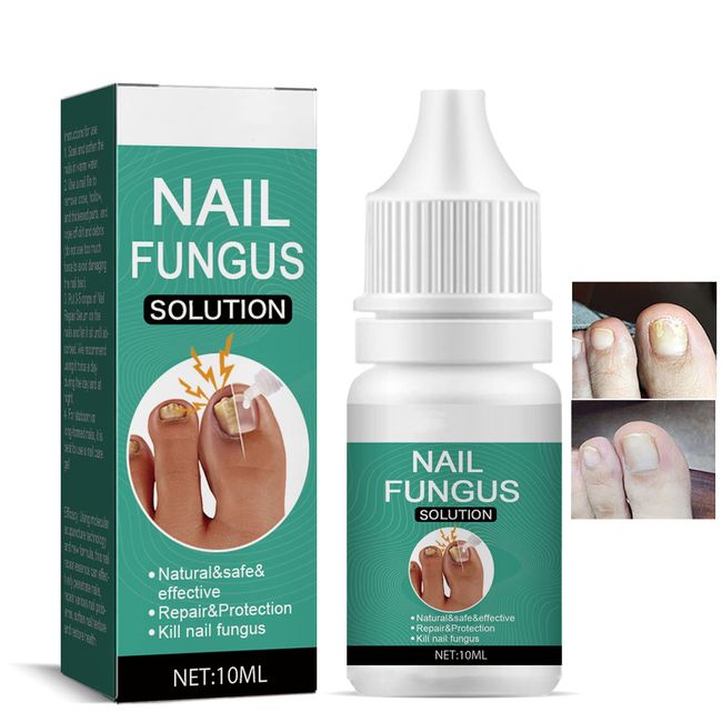 Fungal Nail Treatment for Toenail Extra Strong, 10ML Nail Fungus Solution for Toenail, Toenail Fungus Treatment, Nail Repair for Fingernails Toenails, Strengthen Renew Damaged, Broken Nails