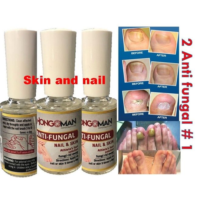 Antifungal Best nail Fungal support FAST support  zana nail quick 2 bt