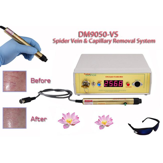 Laser spider capillary vein reduction removal kit for legs face nose & body.