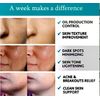 Glycolic Acid 20% Resurfacing Pads for face,chest ,back acne