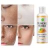 Toner for Dark Spots Turmeric Dark Spot Corrector Toner, Facial Toner for Acne Prone Skin, Dark Spot Remover for Face Hydrating Face Toner for Women, Hyperpigmentation Treatment for Dry Oily Skin 4OZ