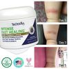 TriDerma Intense Fast Healing Cream, Decreases Healing Time for Minor Irritations, Rashes, Scrapes, Cuts 4 Ounces