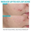La Roche Posay Effaclar Anti-Aging Serum - 30 gr