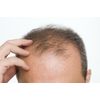 immune system defense - DHT BLOCKER HAIR FORMULA - selenium tablets 2 Bottles