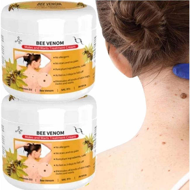 Lenaro Bee Venom Wart and Tag Remover, Lenaro Bee Venom Mole and Wart Treatment Cream,Bee Venom Wart Remover Cream, Fast-Acting & Effective Skin Tag Remover,Easy Application & No Irritation(2 pcs)