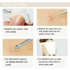 7pcs Blackhead Acne Comedone Pimple Blemish Extractor Remover Tool Kit Set