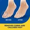 Dr. Scholl's Liquid Corn & Callus Remover, 0.33 Ounce // Removes 4 Piece Set