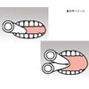 Lion Dental Material Bite Tube Ellac Bite Tube