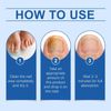 Fungal Nail Treatment