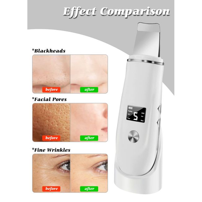 Skin Scraper Tool, For Facial Deep Cleansing Skin