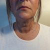 New Neck Miracle Tape