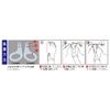Alphax Nail Care, Nail Protection, Beautiful Foot Nail Protection Pad (Pack of 2), Made in Japan
