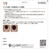 [2nd-Class OTC Drug] Tsumura Kampo Shoseiryuto Extract Granules 48 Packs * Products subject to the self-medication tax system