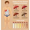 Liver-Rescue Promotes a Healthy Liver Function. Helpful for all liver conditions