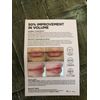 GloPRO Beautybio x Nordstrom Fuller Lips Set