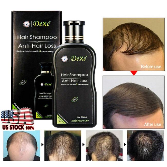 200ml Dexe Original Anti Hair Loss Shampoo Natural Herbal Hair Growth Treatment