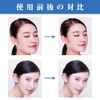 CatMoz Facial Tape Sagging, Wrinkle, Broom Lines, Lifts, 40 Count