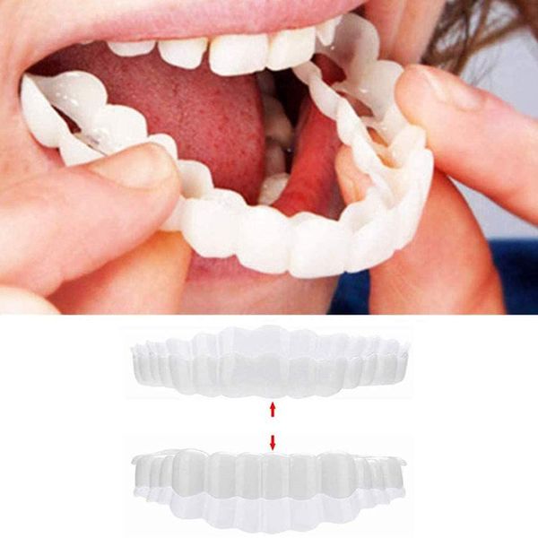 1 Pair Instant Top and Bottom Brace Teeth Whitening Veneer Instant Teeth Repair Kit to cover irregular dirty missing or cracked teeth