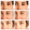 Retinol Serum for Face 2.5%, B5 Herbal Resurfacing Retinol Serum with Vitamin C, Vitamin E, Hyaluronic Acid, Serum for Anti-Aging, Wrinkle Smoothing, Dark Spot Corrector, Brighten Dullness