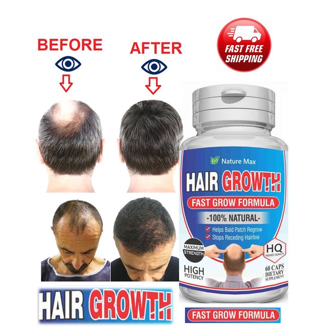 DHT Blocker For Men or Women Hair Growth Loss Herbal Capsules